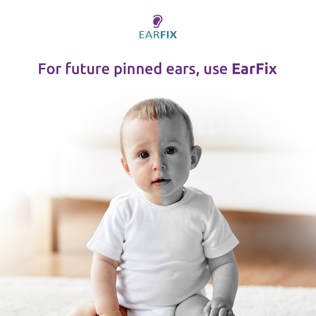 EarFix Mini Ear Corrector – 8-Pack Ear Stickers to Hold Back The Ear – Ear Corrector for 3 Months to 3 Years of Age – Waterproof Ear Stickers for Prominent Ears, Protruding Ears