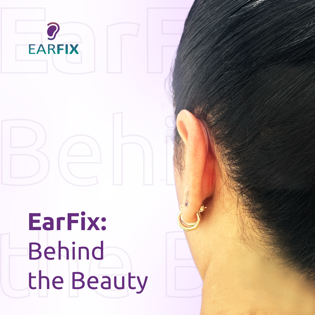 EarFix Ear Corrector – 8-Pack Ear Stickers to Hold Back The Ear – Ear Corrector for Adults and Kids Above 3 Years of Age – Waterproof Ear Stickers for Prominent Ears, Protruding Ears