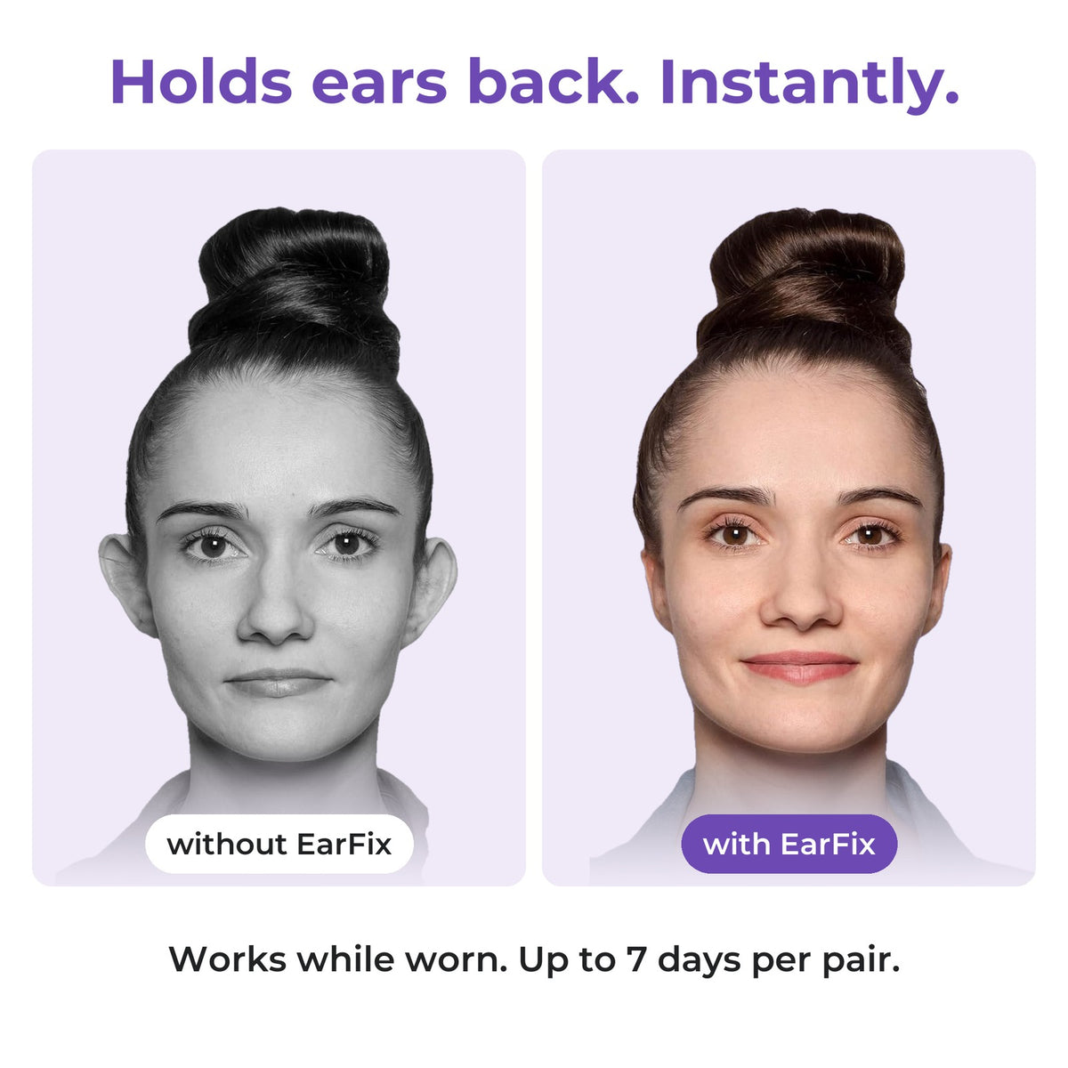 Woman before and after wearing EarFix ear stickers, ears held back