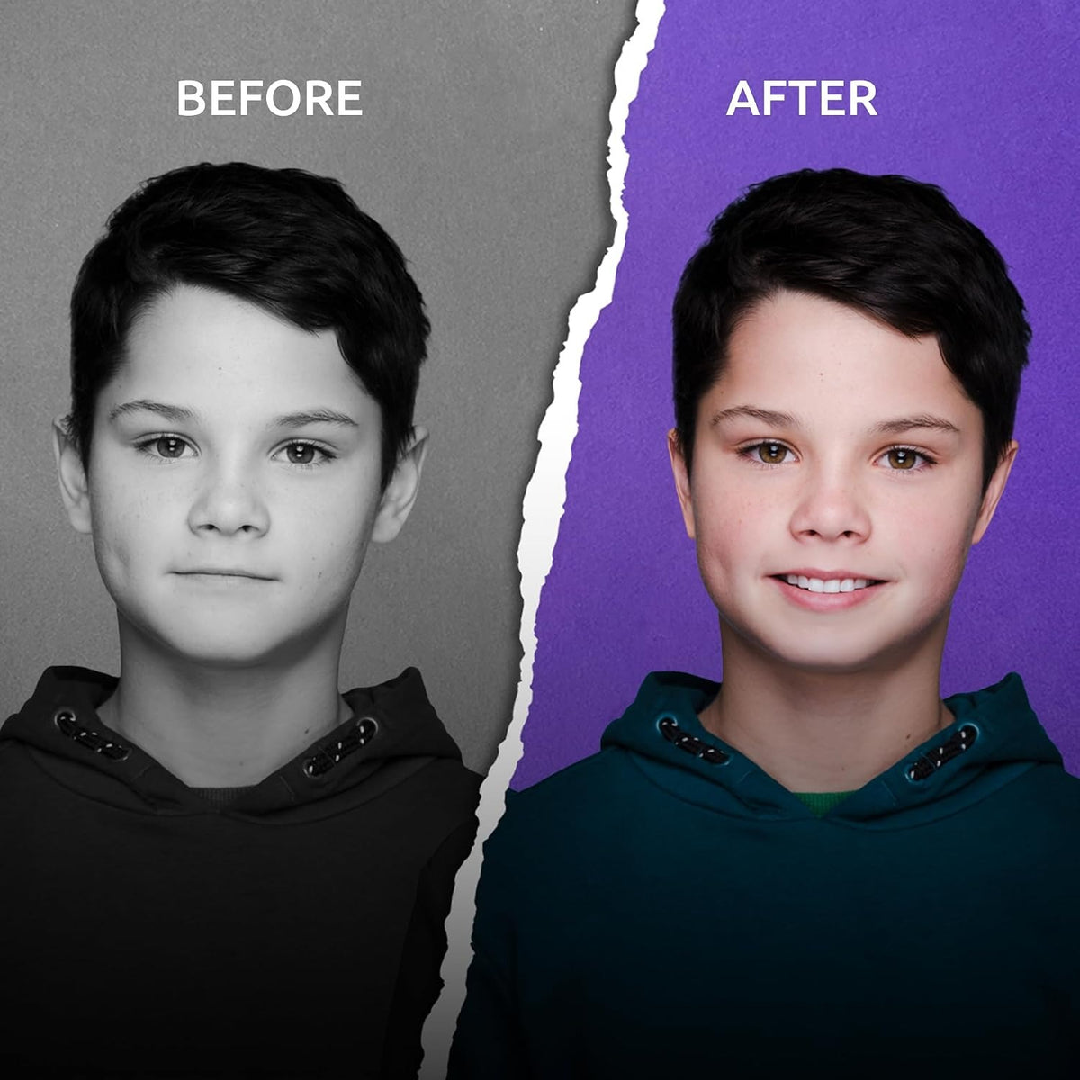 Boy with prominent ears before and after using EarFix ear stickers