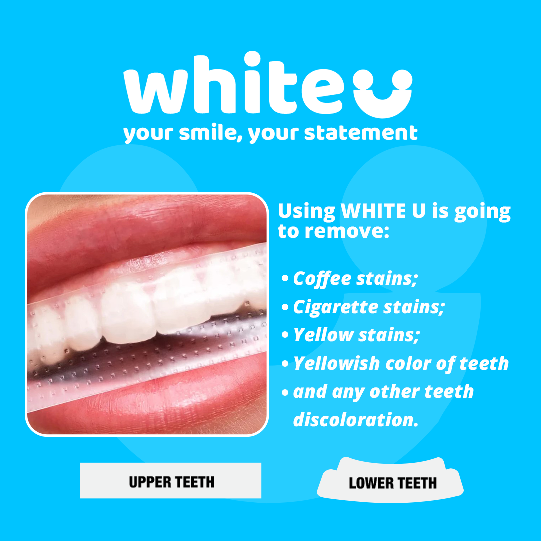 WhiteU teeth whitening strips before and after smile results